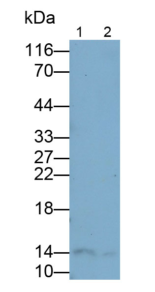 Polyclonal Antibody to Fatty Acid Binding Protein 1 (FABP1)