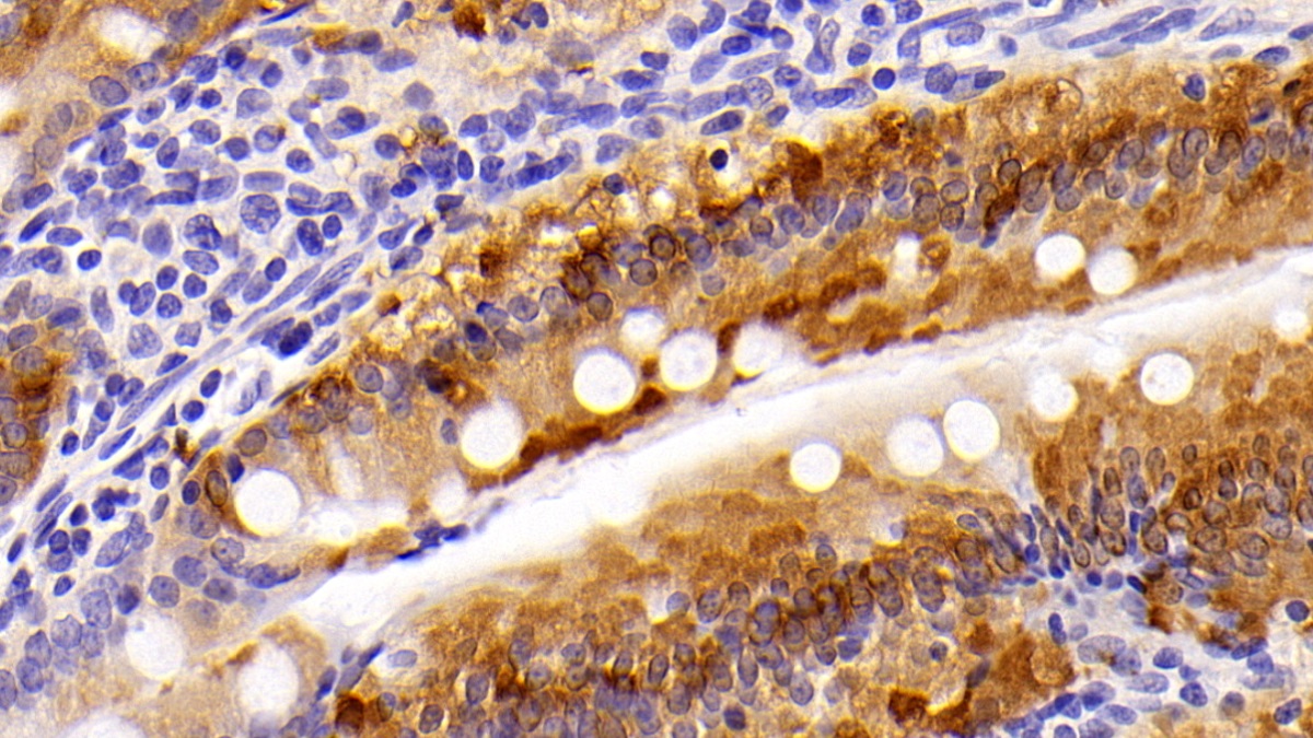 Polyclonal Antibody to Fatty Acid Binding Protein 1 (FABP1)