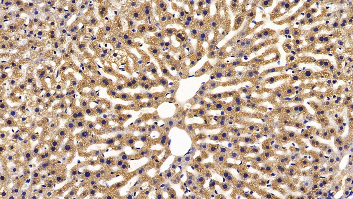 Polyclonal Antibody to Fatty Acid Binding Protein 1 (FABP1)