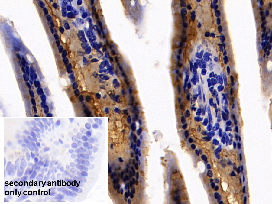 Polyclonal Antibody to Fatty Acid Binding Protein 1 (FABP1)