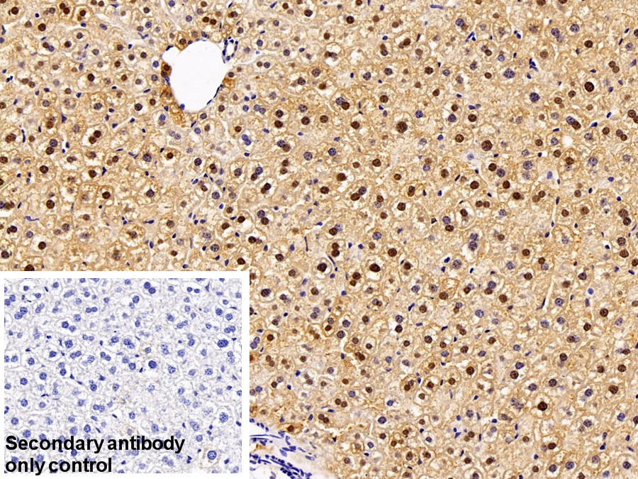 Polyclonal Antibody to Fatty Acid Binding Protein 1 (FABP1)