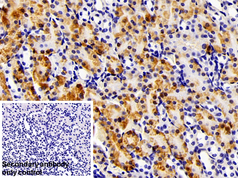 Polyclonal Antibody to Fatty Acid Binding Protein 1 (FABP1)