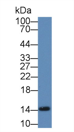 Polyclonal Antibody to Fatty Acid Binding Protein 1 (FABP1)