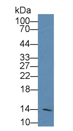 Polyclonal Antibody to Fatty Acid Binding Protein 1 (FABP1)