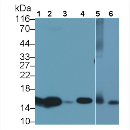 Polyclonal Antibody to Fatty Acid Binding Protein 1 (FABP1)