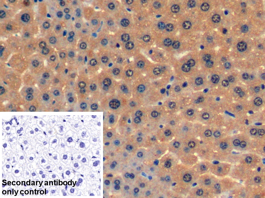 Polyclonal Antibody to Fatty Acid Binding Protein 1 (FABP1)