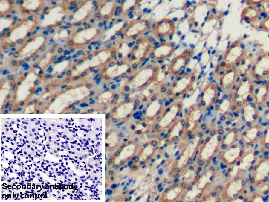 Polyclonal Antibody to Fatty Acid Binding Protein 1 (FABP1)