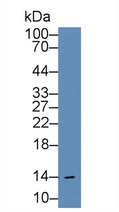 Polyclonal Antibody to Fatty Acid Binding Protein 1 (FABP1)