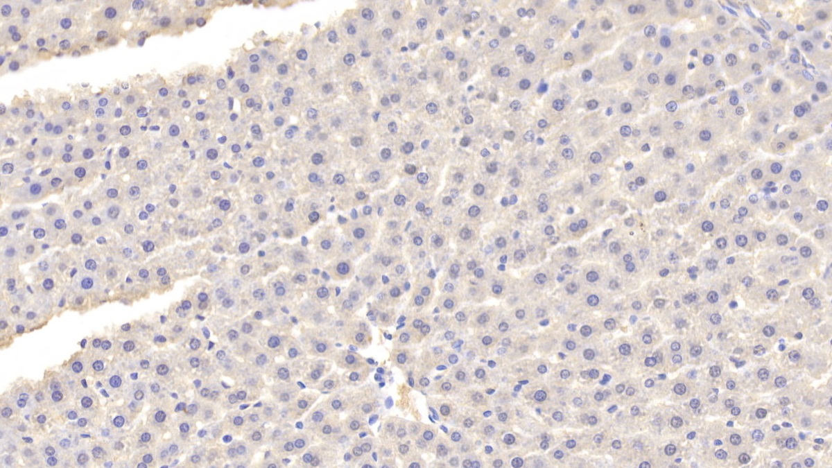 Polyclonal Antibody to Fatty Acid Binding Protein 1 (FABP1)