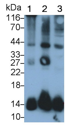 Polyclonal Antibody to Fatty Acid Binding Protein 1 (FABP1)