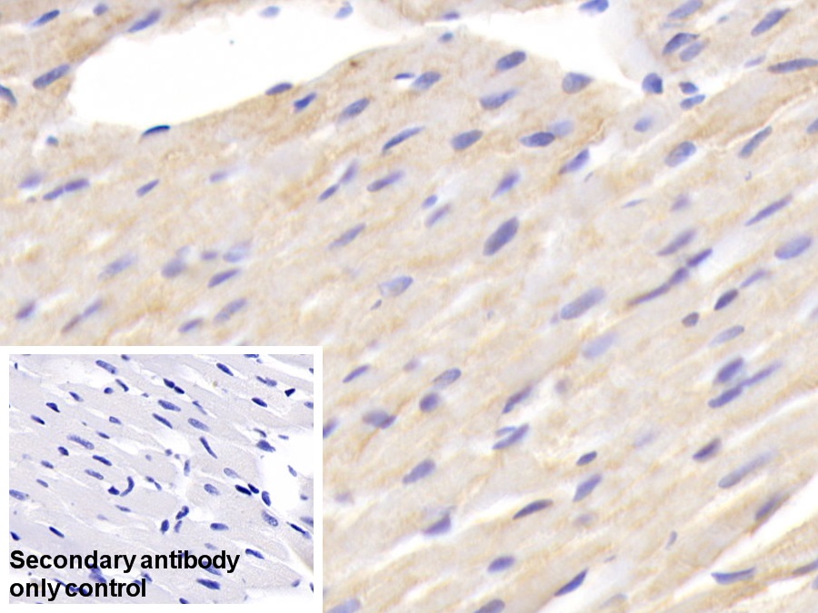 Polyclonal Antibody to Fatty Acid Binding Protein 1 (FABP1)