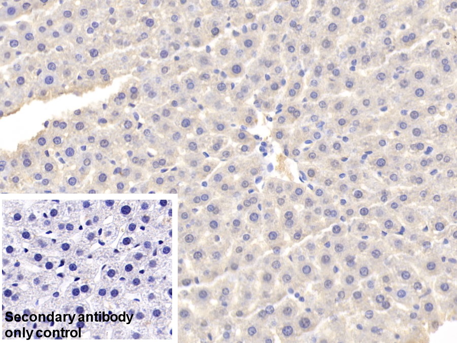 Polyclonal Antibody to Fatty Acid Binding Protein 1 (FABP1)