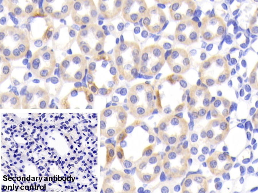 Polyclonal Antibody to Fatty Acid Binding Protein 1 (FABP1)