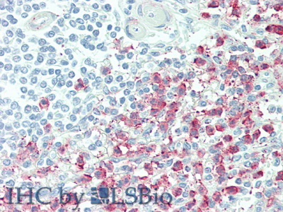 Polyclonal Antibody to Intercellular Adhesion Molecule 4 (ICAM4)