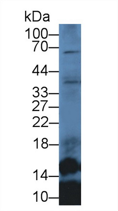 Polyclonal Antibody to Secondary Lymphoid Tissue Chemokine (SLC)