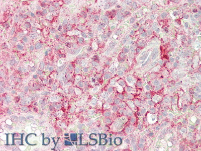 Polyclonal Antibody to Cluster Of Differentiation 32 (CD32)