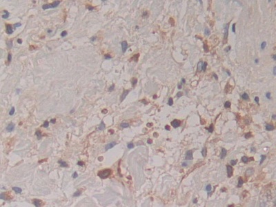 Polyclonal Antibody to Cytohesin 1 (CYTH1)