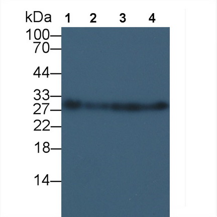 Polyclonal Antibody to Receptor I For The Fc Region Of Immunoglobulin E (FceRI)