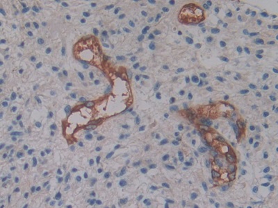 Polyclonal Antibody to Cytohesin 2 (CYTH2)