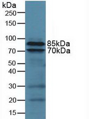 Polyclonal Antibody to Integrin Beta 2 (CD18)