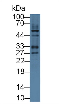 Polyclonal Antibody to Integrin Linked Kinase (ILK)