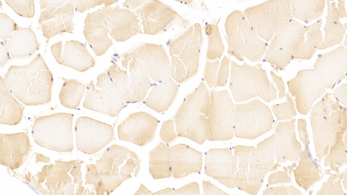 Polyclonal Antibody to Integrin Linked Kinase (ILK)