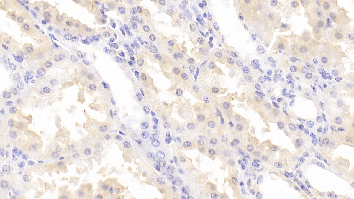 Polyclonal Antibody to Integrin Linked Kinase (ILK)