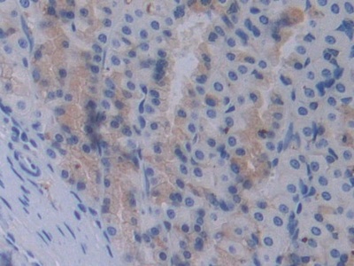 Polyclonal Antibody to Signal Transducing Adaptor Molecule 1 (STAM1)