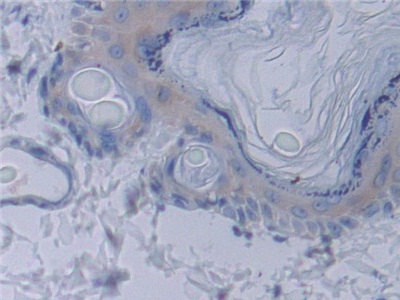 Polyclonal Antibody to Signal Transducing Adaptor Molecule 1 (STAM1)