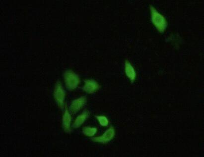 Polyclonal Antibody to Interferon Regulatory Factor 3 (IRF3)