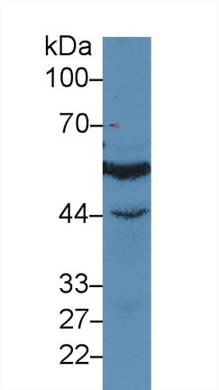 Polyclonal Antibody to Interferon Regulatory Factor 3 (IRF3)