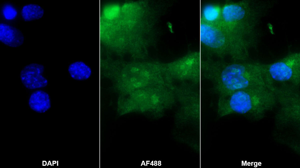 Polyclonal Antibody to Interferon Regulatory Factor 3 (IRF3)