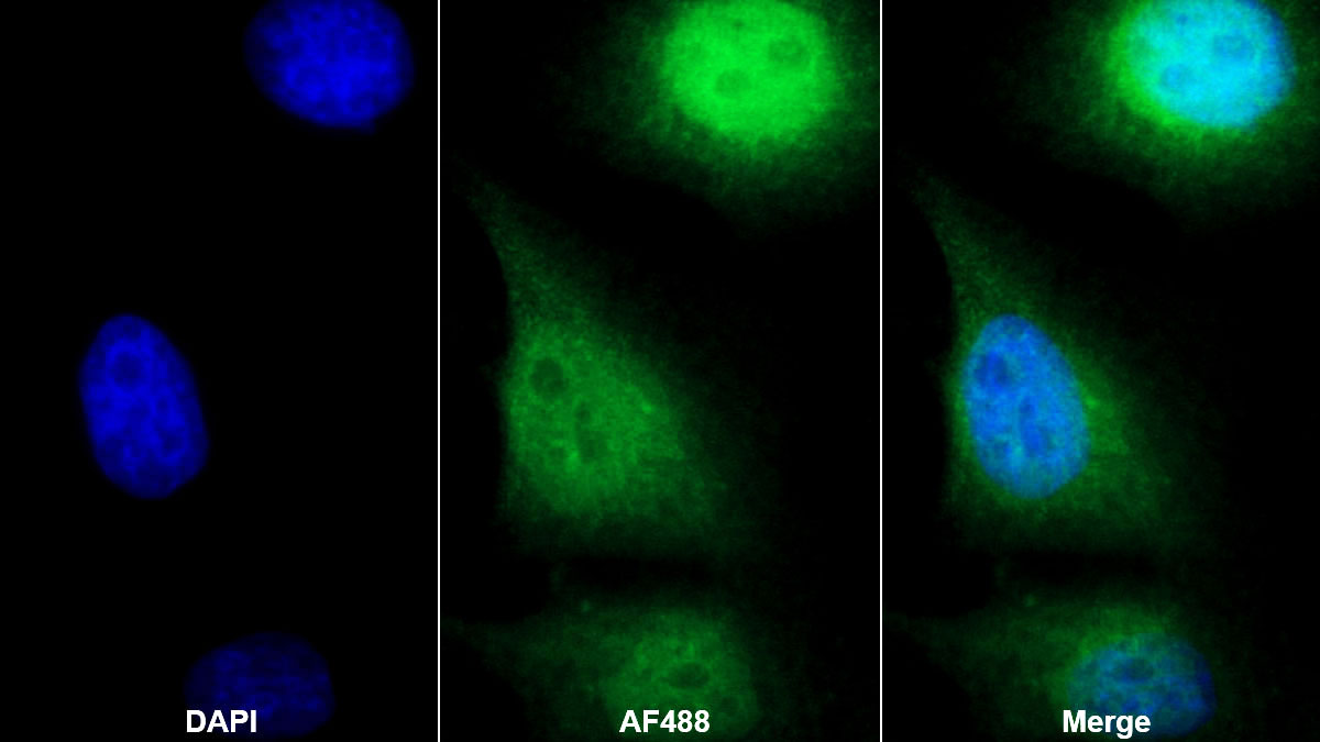 Polyclonal Antibody to Interferon Regulatory Factor 3 (IRF3)