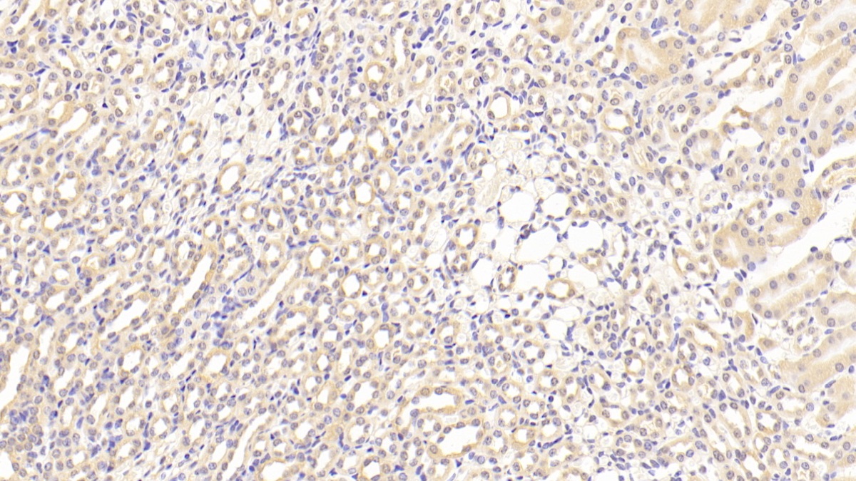 Polyclonal Antibody to Interferon Regulatory Factor 3 (IRF3)