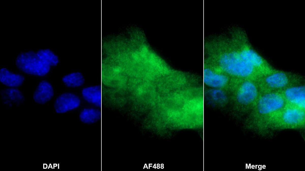 Polyclonal Antibody to Interferon Regulatory Factor 3 (IRF3)