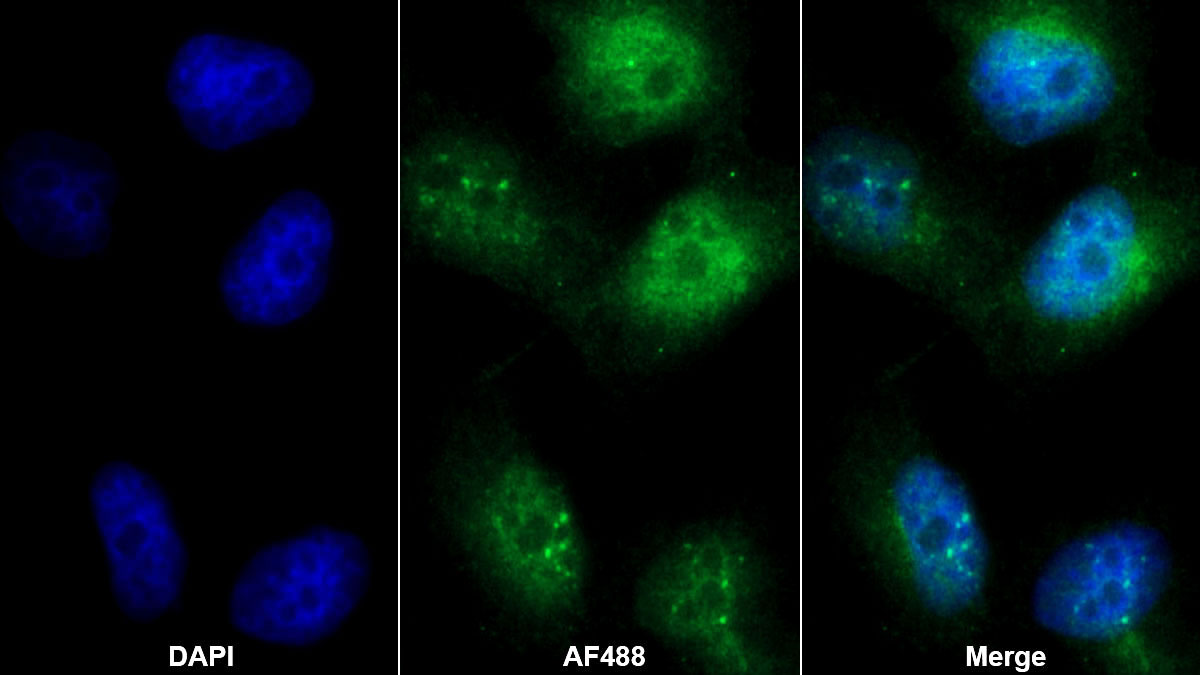 Polyclonal Antibody to Interferon Regulatory Factor 3 (IRF3)