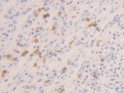 Polyclonal Antibody to Caspase 1 (CASP1)