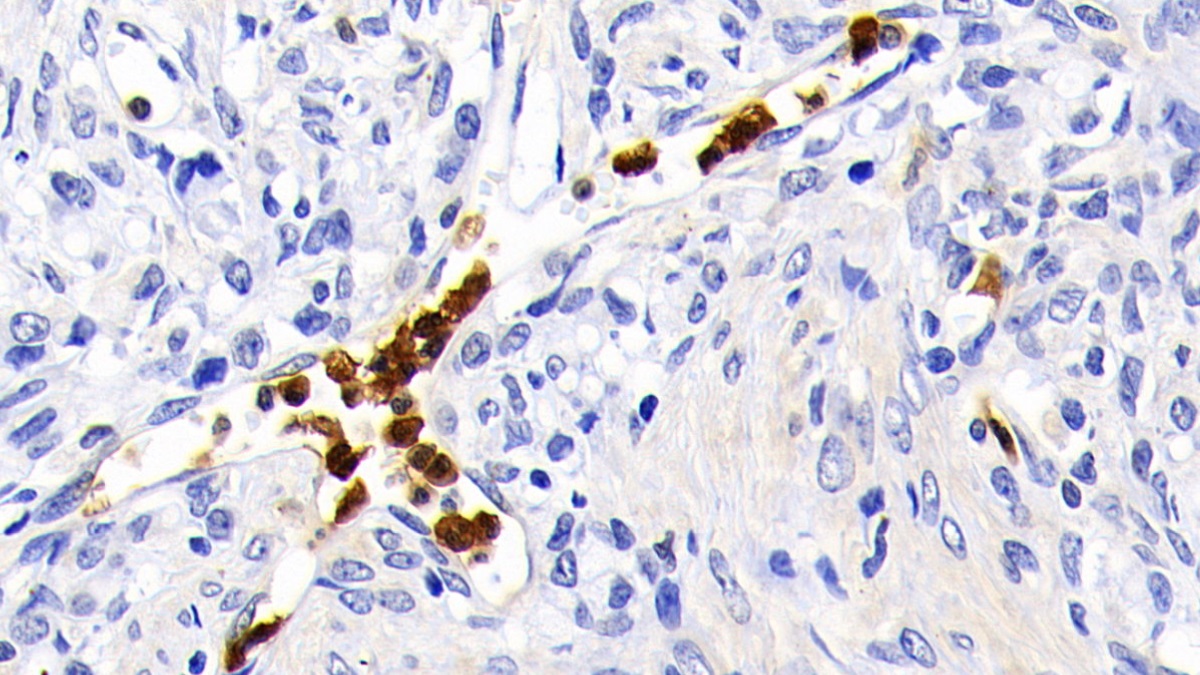 Polyclonal Antibody to Caspase 1 (CASP1)