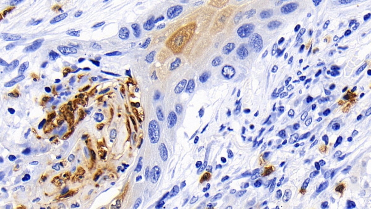 Polyclonal Antibody to Caspase 1 (CASP1)