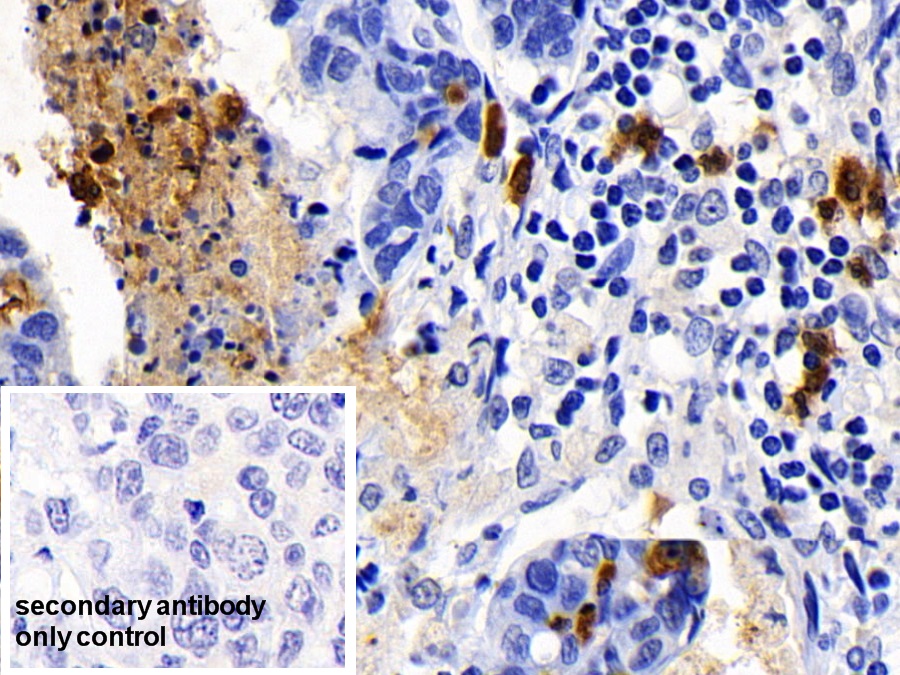 Polyclonal Antibody to Caspase 1 (CASP1)