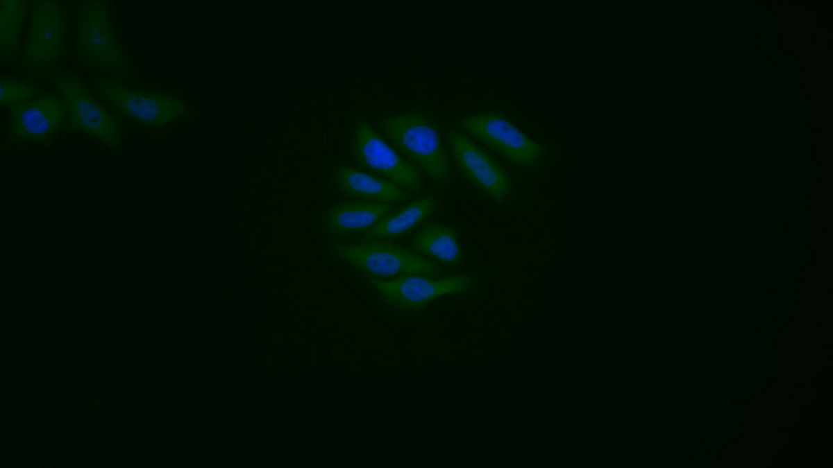 Polyclonal Antibody to Caspase 1 (CASP1)