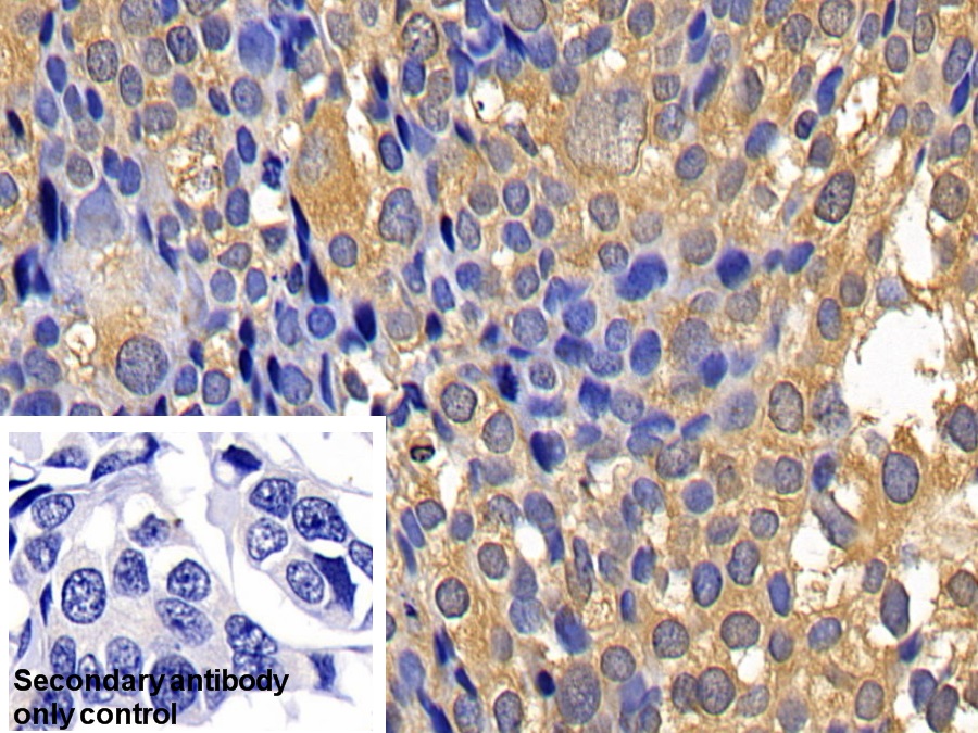 Polyclonal Antibody to Caspase 1 (CASP1)