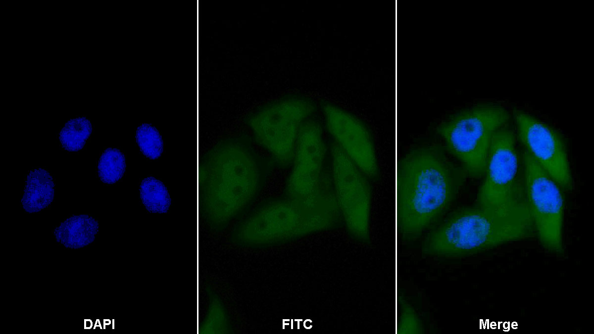 Polyclonal Antibody to Caspase 1 (CASP1)