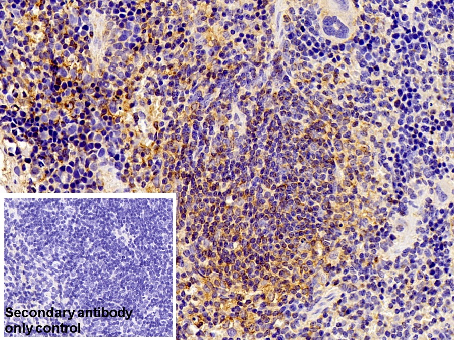 Polyclonal Antibody to Caspase 1 (CASP1)