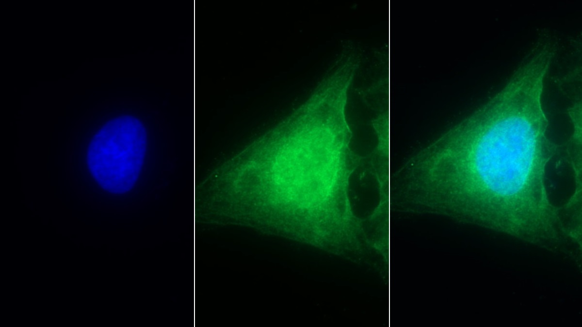 Polyclonal Antibody to Caspase 1 (CASP1)