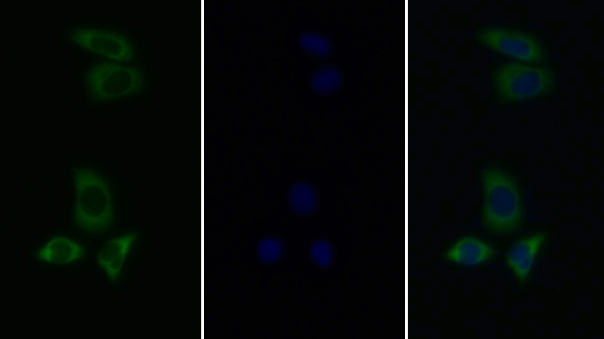 Polyclonal Antibody to Tyrosine Kinase 2 (Tyk2)