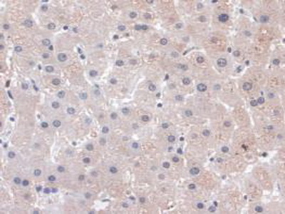 Polyclonal Antibody to Phospholipase C Beta 1 (PLCB1)