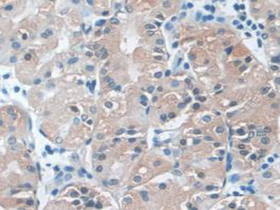 Polyclonal Antibody to Phospholipase C Beta 1 (PLCB1)