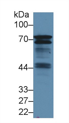 Polyclonal Antibody to B-Cell Linker Protein (BLNK)