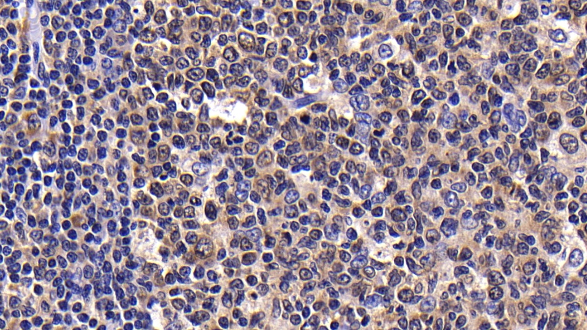 Polyclonal Antibody to B-Lymphocyte Chemoattractant (BLC)